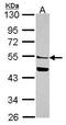 Mannosyl (Alpha-1,6-)-Glycoprotein Beta-1,2-N-Acetylglucosaminyltransferase antibody, GTX114926, GeneTex, Western Blot image 