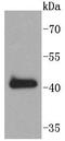 SRY-Box 18 antibody, A04004-1, Boster Biological Technology, Western Blot image 