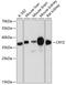 Crystallin Zeta antibody, 14-667, ProSci, Western Blot image 