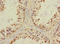 Neuronal acetylcholine receptor subunit alpha-6 antibody, LS-C675531, Lifespan Biosciences, Immunohistochemistry paraffin image 
