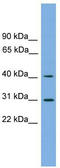 Hydroxy-Delta-5-Steroid Dehydrogenase, 3 Beta- And Steroid Delta-Isomerase 7 antibody, TA339548, Origene, Western Blot image 