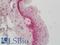 LAD-1 antibody, LS-C316587, Lifespan Biosciences, Immunohistochemistry paraffin image 