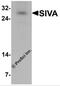 SIVA1 Apoptosis Inducing Factor antibody, 6621, ProSci, Western Blot image 