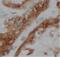 Von Hippel-Lindau Tumor Suppressor antibody, FNab09402, FineTest, Immunohistochemistry frozen image 