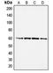 HsMAD2 antibody, LS-C352490, Lifespan Biosciences, Western Blot image 