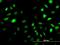 Sestrin-2 antibody, H00083667-M03, Novus Biologicals, Immunocytochemistry image 