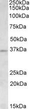 Homeobox D13 antibody, 42-512, ProSci, Immunohistochemistry paraffin image 