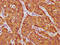 Alpha Fetoprotein antibody, LS-C285699, Lifespan Biosciences, Immunohistochemistry paraffin image 
