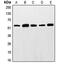 ETS Proto-Oncogene 1, Transcription Factor antibody, MBS822058, MyBioSource, Western Blot image 