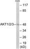 Akt antibody, EKC1927, Boster Biological Technology, Western Blot image 