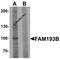 Family With Sequence Similarity 193 Member B antibody, 6941, ProSci, Western Blot image 