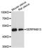 Serpin B13 antibody, A13744, ABclonal Technology, Western Blot image 