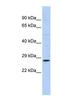 RAB38, Member RAS Oncogene Family antibody, NBP1-58930, Novus Biologicals, Western Blot image 