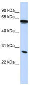 Immunoglobulin Superfamily Member 1 antibody, TA329526, Origene, Western Blot image 