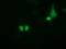 Pseudouridine Synthase 7 antibody, LS-C115706, Lifespan Biosciences, Immunofluorescence image 