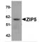 Zinc transporter ZIP5 antibody, MBS151235, MyBioSource, Western Blot image 