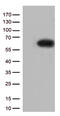 Sequestosome-1 antibody, TA502238, Origene, Western Blot image 