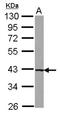 Uroporphyrinogen decarboxylase antibody, NBP2-20818, Novus Biologicals, Western Blot image 