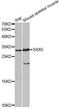 SSX Family Member 5 antibody, A4130, ABclonal Technology, Western Blot image 