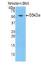 Tissue Factor Pathway Inhibitor antibody, LS-C298553, Lifespan Biosciences, Western Blot image 