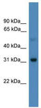 Ladybird Homeobox 1 antibody, TA343621, Origene, Western Blot image 