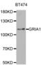 Glutamate Ionotropic Receptor AMPA Type Subunit 1 antibody, abx001509, Abbexa, Western Blot image 