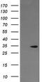 Leucine Rich Repeat Containing G Protein-Coupled Receptor 6 antibody, M05990, Boster Biological Technology, Western Blot image 