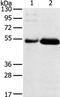 Sterile Alpha Motif Domain Containing 3 antibody, PA5-50875, Invitrogen Antibodies, Western Blot image 
