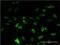 Poly(U) Binding Splicing Factor 60 antibody, H00022827-M20, Novus Biologicals, Immunofluorescence image 