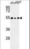 Protein Phosphatase 1 Regulatory Subunit 36 antibody, LS-C167923, Lifespan Biosciences, Western Blot image 