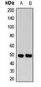 Reticulon 4 Receptor Like 1 antibody, LS-C668940, Lifespan Biosciences, Western Blot image 