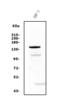 Patched 2 antibody, A06375-1, Boster Biological Technology, Western Blot image 