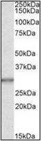 CA1 antibody, AP23069PU-N, Origene, Western Blot image 