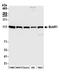 Mitotic checkpoint serine/threonine-protein kinase BUB1 beta antibody, A300-386A, Bethyl Labs, Western Blot image 