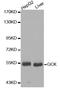 Glucokinase antibody, abx000716, Abbexa, Western Blot image 