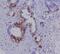 S100 Calcium Binding Protein A4 antibody, M01217-1, Boster Biological Technology, Immunohistochemistry paraffin image 