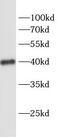 Stearoyl-CoA Desaturase antibody, FNab07627, FineTest, Western Blot image 