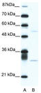 ATF4 antibody, TA335204, Origene, Western Blot image 