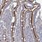 NIMA Related Kinase 10 antibody, NBP1-81991, Novus Biologicals, Immunohistochemistry paraffin image 