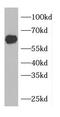 CDK5 Regulatory Subunit Associated Protein 1 Like 1 antibody, FNab01565, FineTest, Western Blot image 