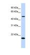 Uncharacterized protein C5orf55 antibody, NBP1-70474, Novus Biologicals, Western Blot image 