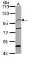 N(Alpha)-Acetyltransferase 15, NatA Auxiliary Subunit antibody, GTX115560, GeneTex, Western Blot image 