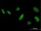 Dehydrogenase/Reductase X-Linked antibody, H00207063-B01P, Novus Biologicals, Immunocytochemistry image 