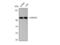 Histone Deacetylase 2 antibody, STJ93478, St John