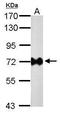 Urease B antibody, MA5-16311, Invitrogen Antibodies, Western Blot image 