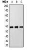 Cytochrome P450 Family 8 Subfamily B Member 1 antibody, LS-C353714, Lifespan Biosciences, Western Blot image 
