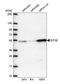 Eukaryotic translation initiation factor 3 subunit E antibody, HPA023973, Atlas Antibodies, Western Blot image 