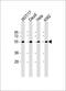 Natural Killer Cell Cytotoxicity Receptor 3 Ligand 1 antibody, GTX53508, GeneTex, Western Blot image 