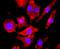Glutamate Ionotropic Receptor NMDA Type Subunit 1 antibody, NBP2-66982, Novus Biologicals, Immunocytochemistry image 