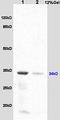 Hydroxysteroid 17-Beta Dehydrogenase 2 antibody, orb5475, Biorbyt, Western Blot image 
